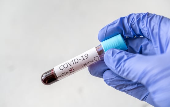 Coronavirus testing probe photo
