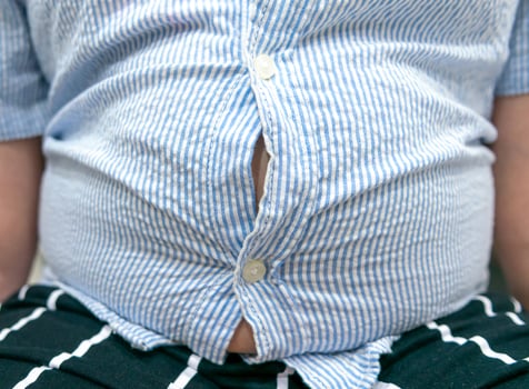 Tight shirt of obese fat boy overweight. photo
