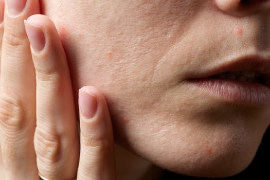 Face skin of young lady between 30 and 35 years old. Closeup photo