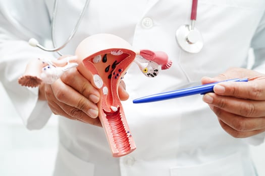 Uterus, doctor holding anatomy model for study diagnosis and treatment in hospital. photo