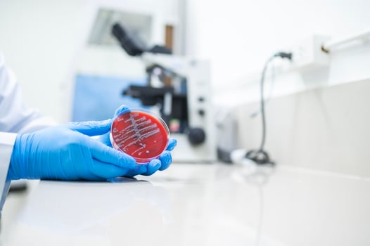 Doctor holding white bacteria on blood agar in hospital microbiology department bacteria identification photo