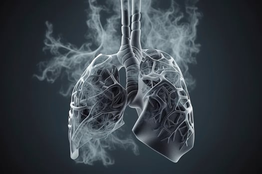 Human Lungs with smoke, Lung disease from smoking, pm 2.5 and air pollution,Human Lung model illness, Lung cancer, and lung disease, photo