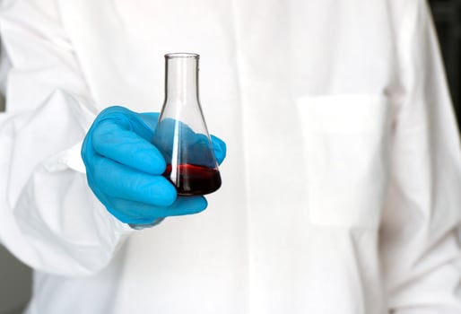 doctor's hand with blood flask, medical diagnostics photo