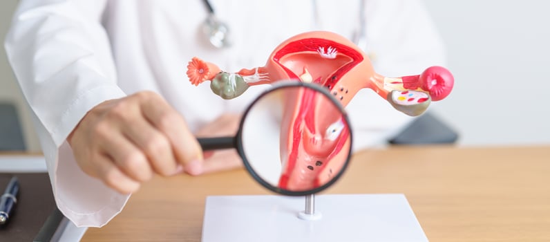 Doctor with Uterus and Ovaries anatomy model and magnifying glass. Ovarian and Cervical cancer, Cervix disorder, Endometriosis, Hysterectomy, Uterine fibroids, Reproductive system, Pregnancy photo