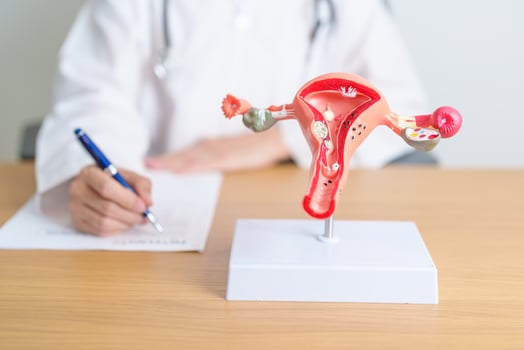 Doctor with Uterus and Ovaries anatomy model. Ovarian and Cervical cancer, Cervix disorder, Endometriosis, Hysterectomy, Uterine fibroids, Reproductive system, Pregnancy and health concept photo