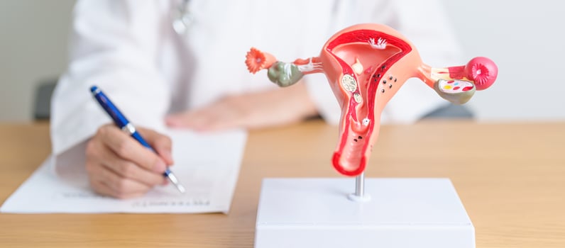 Doctor with Uterus and Ovaries anatomy model. Ovarian and Cervical cancer, Cervix disorder, Endometriosis, Hysterectomy, Uterine fibroids, Reproductive system, Pregnancy and health concept photo