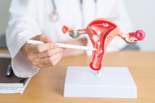Doctor with Uterus and Ovaries anatomy model. Ovarian and Cervical cancer, Cervix disorder, Endometriosis, Hysterectomy, Uterine fibroids, Reproductive system, Pregnancy and health concept photo
