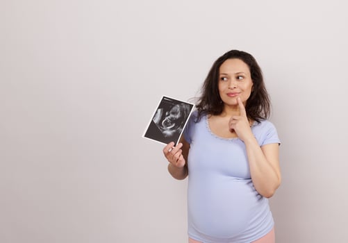 Emotional charismatic pensive pregnant woman with ultrasound scan of baby, dreamily looking aside a copy space on white photo