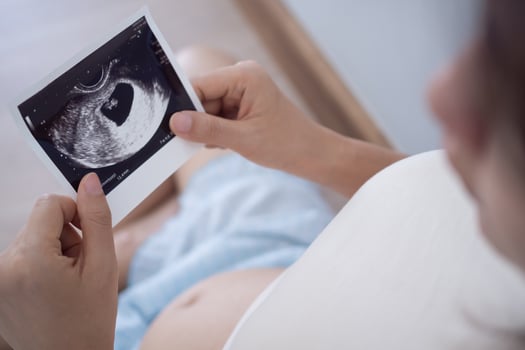 pregnant woman is looking at an ultrasound photo of fetus. Mother gently touches the baby on stomach. Happy, family, growth, pregnancy, enjoyment , prepare newborn, take care, healthcare, tummy.