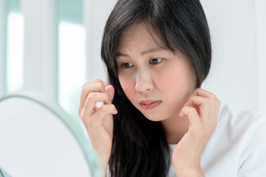 Young woman are worried about faces Dermatology and allergic to steroids in cosmetics. sensitive skin, red face from sunburn, acne, allergic to chemicals, rash on face. skin problems and beauty photo