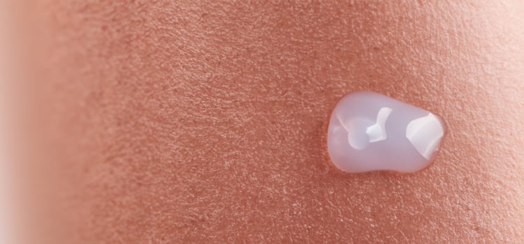 Collagen And Hyaluron Serum Gel On Skin. Splashing of Hyaluron gel. photo