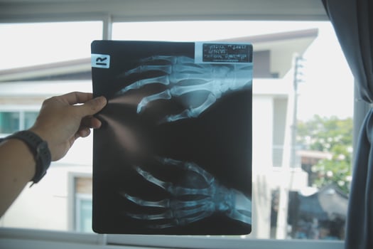 Doctors discussing over medical x-ray in clinic photo