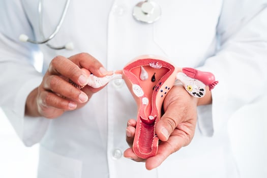 Uterus, doctor holding anatomy model for study diagnosis and treatment in hospital. photo