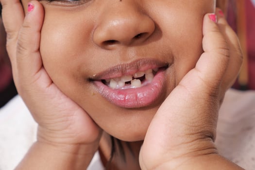 detail shot of child with teeth missing photo