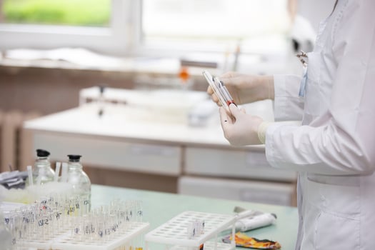 Medical laboratory. The doctor's hands are holding glass test tubes. photo