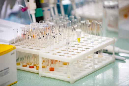 Many glass test tubes with analyzes in a medical laboratory. photo