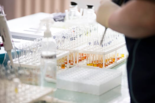 Many glass test tubes with analyzes in a medical laboratory. photo