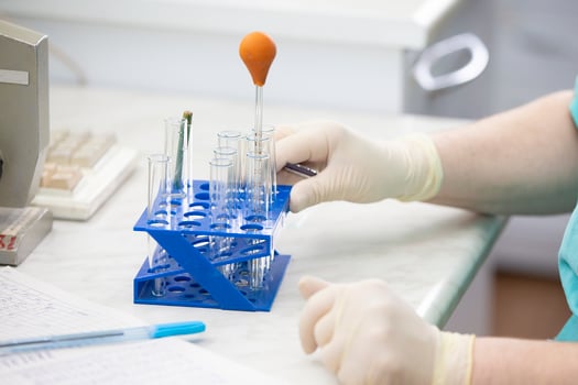 Hands of a doctor-laboratory assistant in rubber gloves hold glass test tubes. photo