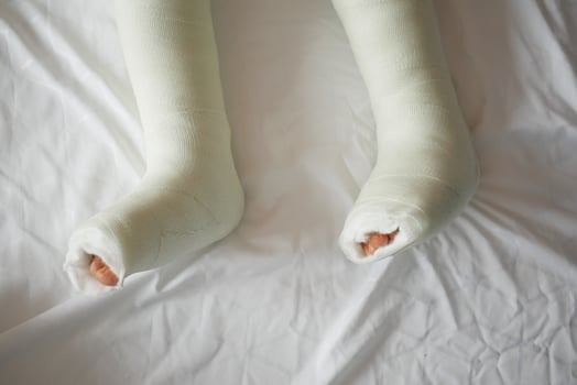 little child with plaster bandage on leg. photo