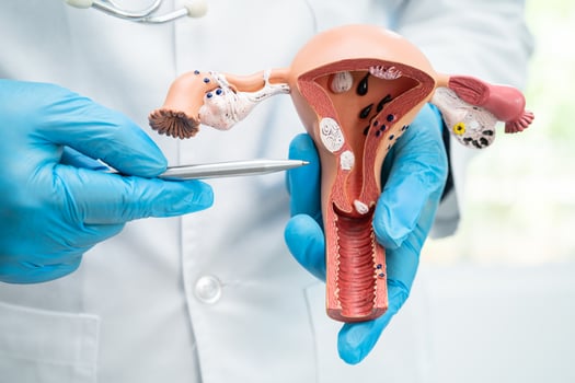 Uterus, doctor holding anatomy model for study diagnosis and treatment in hospital. photo