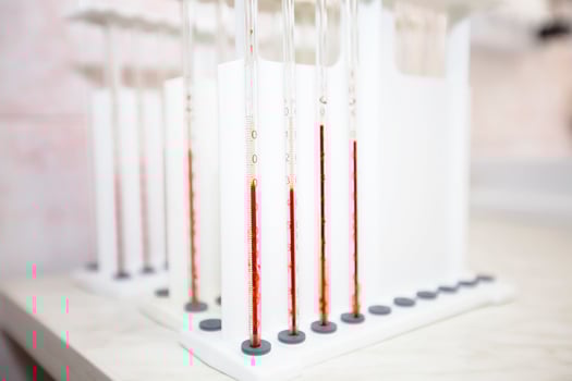 Test tubes with blood in a medical biochemical laboratory. photo