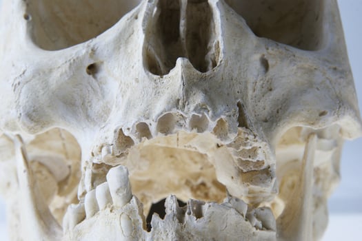 The human skull photo