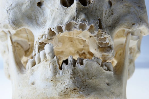 The human skull photo