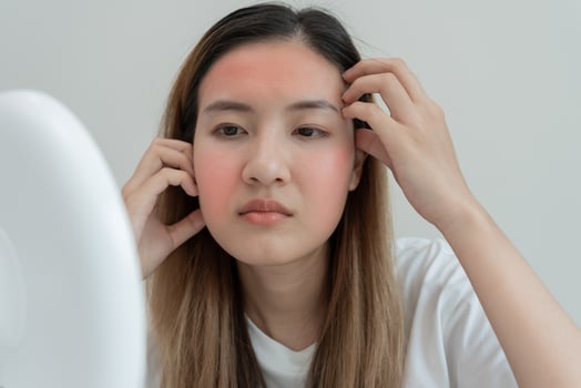 Young woman asian are worried about faces Dermatology and allergic to steroids in cosmetics. sensitive skin, red face from sunburn, acne, allergic to chemicals, rash on face. skin problems and beauty photo