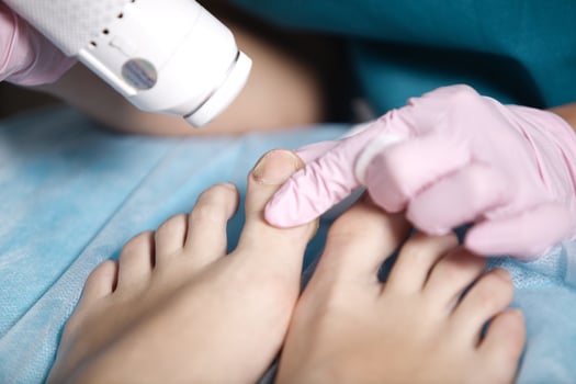 Woman receiving laser treatment on her feet photo