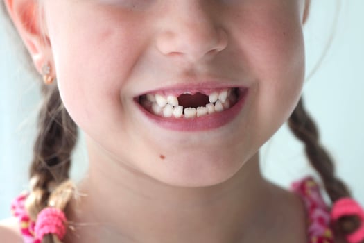 Close-up smile of a girl. A beautiful little girl 6-7 years old has lost milk teeth. Loss of milk teeth, replacement of permanent teeth. photo