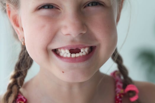 Close-up smile of a girl. A beautiful little girl 6-7 years old has lost milk teeth. Loss of milk teeth, replacement of permanent teeth. photo