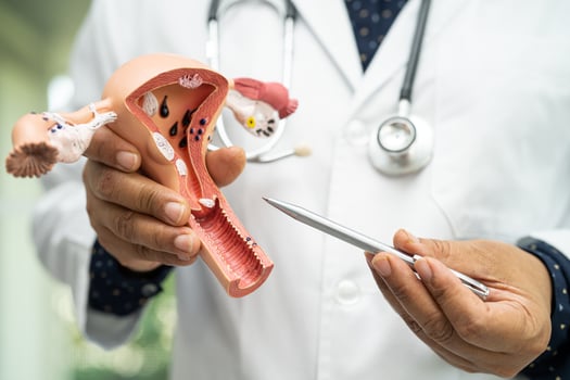 Uterus, doctor holding anatomy model for study diagnosis and treatment in hospital. photo