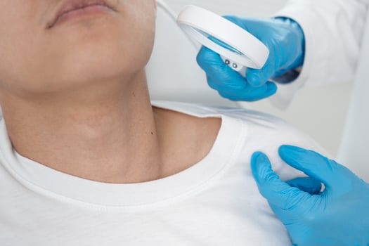 skin problem of asian man. Dermatologist use magnifying glass look itchy skin from skin allergic, steroid allergy, sensitive skin, chemical allergy, rash, insect bites, Dermatitis. photo