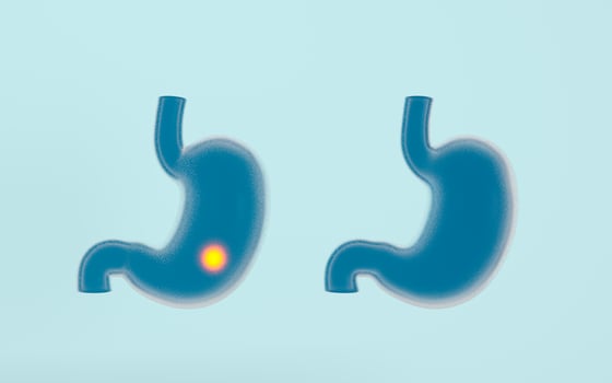 Human Internal Stomach with pain illness, 3d rendering. photo