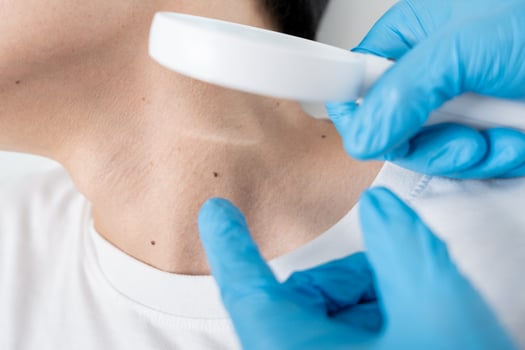 skin problem of asian man. Dermatologist use magnifying glass look itchy skin from skin allergic, steroid allergy, sensitive skin, chemical allergy, rash, insect bites, Dermatitis. photo