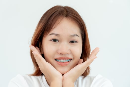 Treatment. Dental Care. Beautiful asian Woman Healthy Smile.Metal Brackets on Teeth. young Female Smile with Braces and show beautiful  of teeth, Care after braces, confident in orthodontics photo