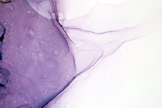 Blue, pink, green, purple, red, red, yellow haze on a black background. Part of original alcohol ink painting. Modern art. Abstract colorful background, wallpaper. Marble texture. Fluid Art. photo