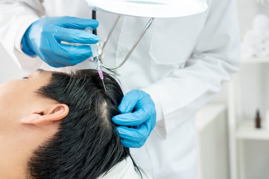 Specialist of hair injection hair tonic for Asian man, damaged hair, hair loss, thinning problem, vitamin deficiency, baldness, postpartum, biotin, zinc, endocrine disorders, hormonal imbalanc photo