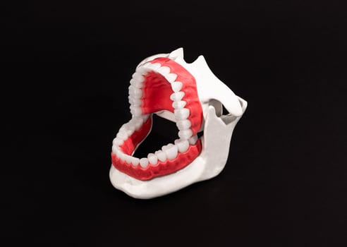 Human jaw with teeth and gums anatomy model isolated on black background. Opened jaw position. Healthy teeth, dental care, and orthodontic medical healthcare concept. photo