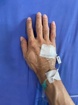Intravenous fluid infusion at patient hand photo