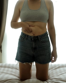 Close up of a belly with scar from c-section and abdominal fat. Women's health. A woman dressed up in sportswear demonstrating her imperfect body after a childbirth with nursery on the background. photo