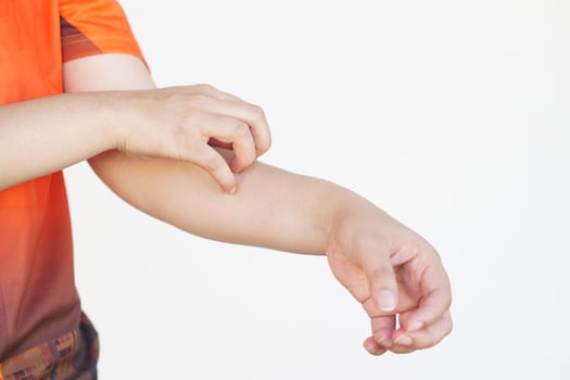 Close up woman hand is scratching her itchy arm. Concept, health problem. Itchy from allergy, rashes, dry skin,  insects bite, fungus or dermatitis. photo