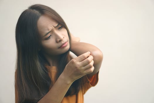 Asian woman having itchy skin on arm photo