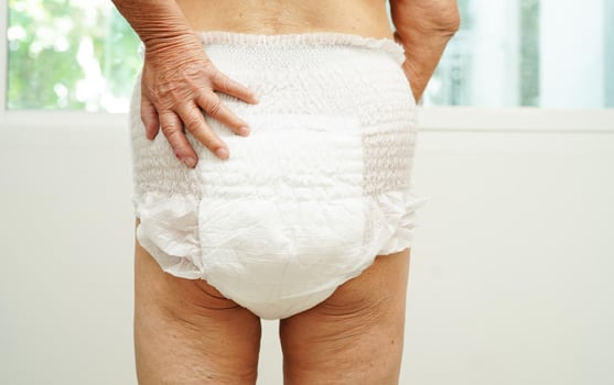 Asian senior woman patient wearing adult incontinence diaper pad in hospital. photo