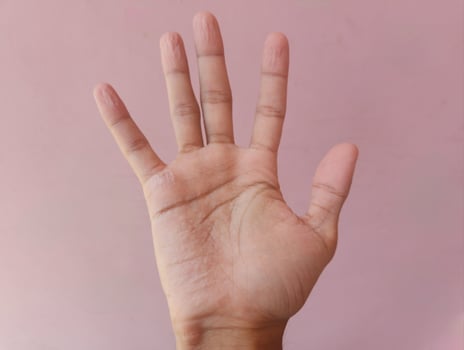 Wrinkly Hands After Swimming. Fingers get so wrinkly after bathing photo