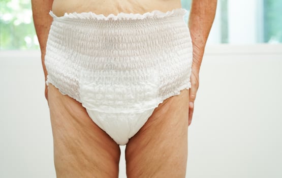 Asian senior woman patient wearing adult incontinence diaper pad in hospital. photo