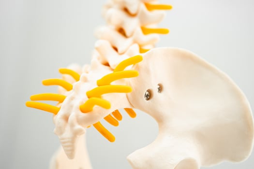 Lumbar spine displaced herniated disc fragment, spinal nerve and bone. Model for treatment medical in the orthopedic department. photo