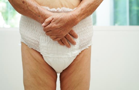 Asian senior woman patient wearing adult incontinence diaper pad in hospital. photo