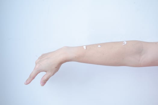 Woman's arm with skin cream waiting for skin care rub photo