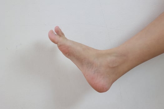 Leg on white background photo